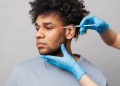 Does Donor Hair Grow Back? Understanding Extraction Sites