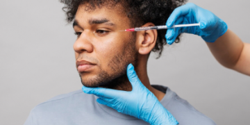 Does Donor Hair Grow Back? Understanding Extraction Sites